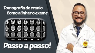 Tomografia de cranioComo alinhar o exameserie passo a passo [upl. by Fabi]