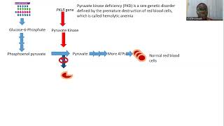 Pyruvate Kinase Deficiency [upl. by Yelyak]