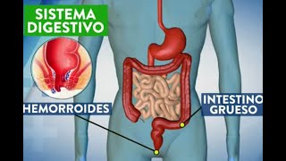 Hemorroides ¿qué son por qué salen y cómo curarlas [upl. by Inaja]