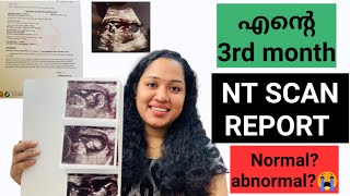 3 Month pregnancy baby development malayalam [upl. by Yeltneb505]