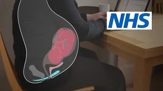 How and when should I do pelvic floor exercises  NHS [upl. by Jonna894]