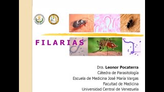 Filariasis linfática Wuchereria bancrofti  Mansonelosis [upl. by Solnit297]