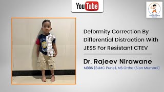 Deformity correction by differential distraction with JESS for resistant CTEV Done by Dr Nirawane [upl. by Akenet757]