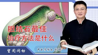 胆结石最佳治疗方法是什么 [upl. by Nairda590]