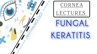 CORNEA LECTURE 6 FUNGAL KERATITIS [upl. by Lewej]