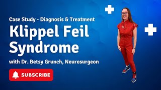 Case study 140  KlippelFeil Syndrome  explained by neurosurgeon Dr Betsy Grunch [upl. by Heller755]