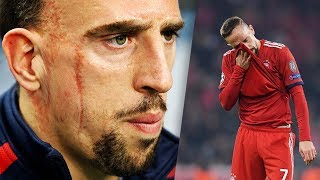 What’s the story of Franck Ribery’s scars [upl. by Itnavart]