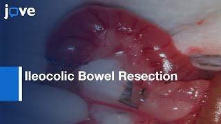 How to treat acute ileus bowel obstruction [upl. by Dillon152]