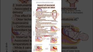 Impact of neuraxial anesthesia on labor [upl. by Keelia]