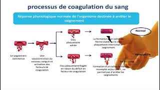 Hemato 10Coagulation  Hémophilie Dr Abbadi [upl. by Sugihara492]