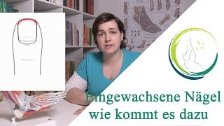 Eingewachsene Nägel wie kommt es dazu podologinandrea [upl. by Rez]