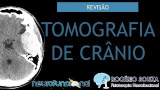 TOMOGRAFIA DE CRÂNIO Vídeo Aula  Rogério Souza [upl. by Llerret793]