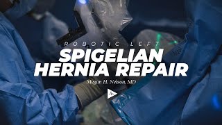 Robot Assisted Ventral Hernia Repair Spigelian  Preview [upl. by Lehsreh472]