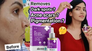 Derma co Kojic acid face wash and serum for 1 month  Honest Review skincare [upl. by Ynnob55]