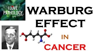 NEOPLASIA 6 WARBURG EFFECT Hallmark of CANCER What Why amp How [upl. by Kcuhc]