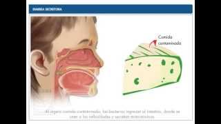 Diarrea Secretoria [upl. by Ailedroc44]