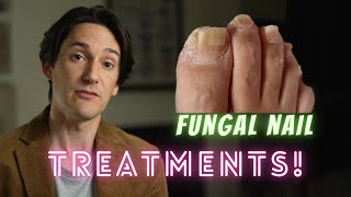 Fungal Nail Treatments [upl. by Forrester]