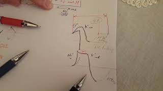 ECG made easy  Hyperkalemia amp Hypokalemia [upl. by Nytram]