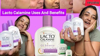 Lacto Calamine Uses And Benefits Reviews in Hindi  For Oily amp Dry Skin How To Apply Lacto Calamine [upl. by Ambrosane324]