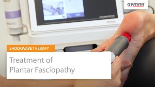 Treatment of Plantar Fasciopathy with Shockwave Therapy [upl. by Norret]