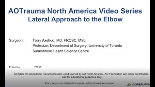 Elbow  Lateral Approach [upl. by Hermine333]