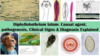 Pathogenic significance clinical signs and diagnosis of Diphyllobothrium latum infestation [upl. by Vito]