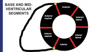 Cardiac Segmentation [upl. by Gievlos28]