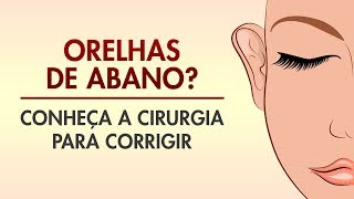 OTOPLASTIA ORELHA DE ABANO COMO É FEITA DREAM PLASTIC  CIRURGIA PLÁSTICA [upl. by Laeira]