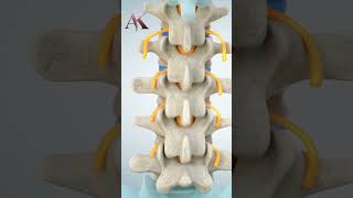 Understanding Intervertebral Discs amp Disc Herniation by Dr Abhijit Kulkarni  Brain amp Spine Surgeon [upl. by Frodine]