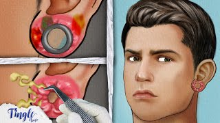 🔴 LIVE ASMR ANIMATION BIG HOLE SWOLLEN EAR CLEANING  Stop Motion  Tingle Trick [upl. by Schofield]