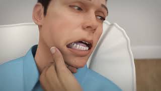 Buccal Midazolam Training Video [upl. by Annaitat]