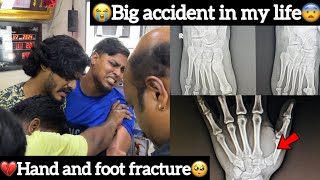 😭Big accident in my life￼🥺💔Hand and foot fracture😨 Aj Squad  Ajees [upl. by Coumas]