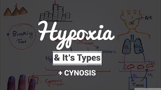 Hypoxia Definition Causes Symptoms and Treatment What is hypoxia and how dangerous is it [upl. by Altis]