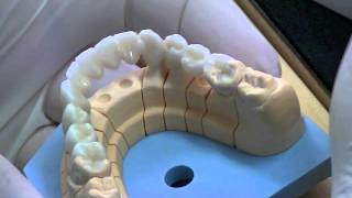 NexxZr Full Contour  Colorazione Zirconia Integrale [upl. by Anaoy]