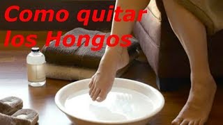 Como quitar los Hongos de las uñas de los pies👠 [upl. by Ellevel763]