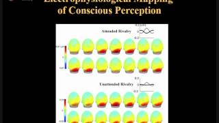 Understanding the EEG [upl. by Ecille735]