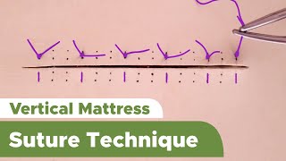 Suture Techniques and Training Series Interrupted Vertical Mattress Suture Technique [upl. by Aruasor759]