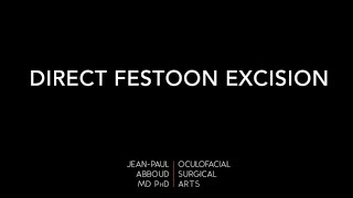 Direct Surgical Excision of Festoons with Dr JeanPaul Abboud [upl. by Eaner]