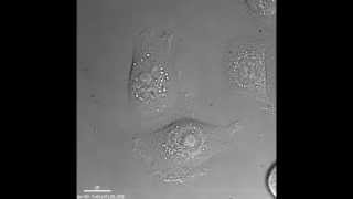 Keratinocyte cell movements [upl. by Eilis780]