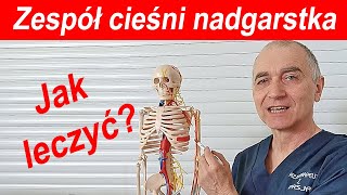 Jak leczyć zespół cieśni nadgarstka [upl. by Ssalguod784]