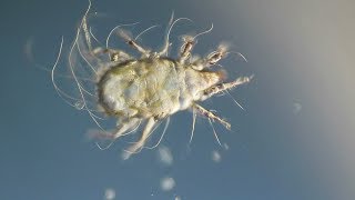 Dust Mite Under the Microscope [upl. by Nytsirt]