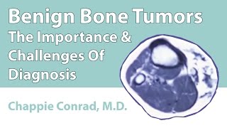 Qual a diferença entre tumor benigno e maligno [upl. by Anifur]