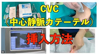 研修医必見❗CVC中心静脈カテーテルの挿入方法、手順 [upl. by Dickman]