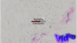 Vadimon Csupo Effects Sponsored by Preview 2 Effects [upl. by Wilkison]