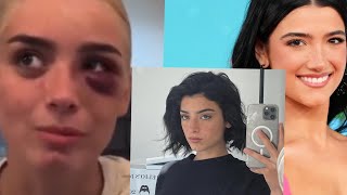 dixiedamelio Beaten up By Her sister Charlie Damelio full video [upl. by Eciryt923]