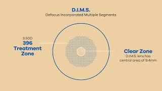 LENTE MIYOSMART PARA EL CONTROL DE MIOPIA  EXPLICACIÓN TÉCNICA Y CIENTÍFICA [upl. by Destinee]