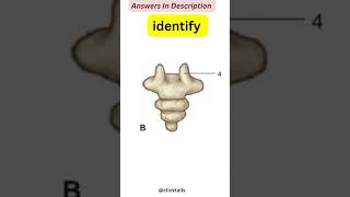 identify the parts of vertebrae Quiz  vertebral column anatomy quiz [upl. by Eak849]