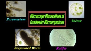 🔬🦠 Pond Water Under Microscope  Mr Pauller [upl. by Bailey274]