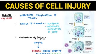 Cell Injury 12  Causes of Cell Injury  Pathology  EOMS [upl. by Eatnoled]