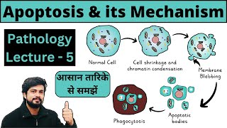 Apoptosis  Programmed Cell Death  Mechanism  Intrinsic amp Extrinsic Pathway  Pathology Lecture [upl. by Sokil]